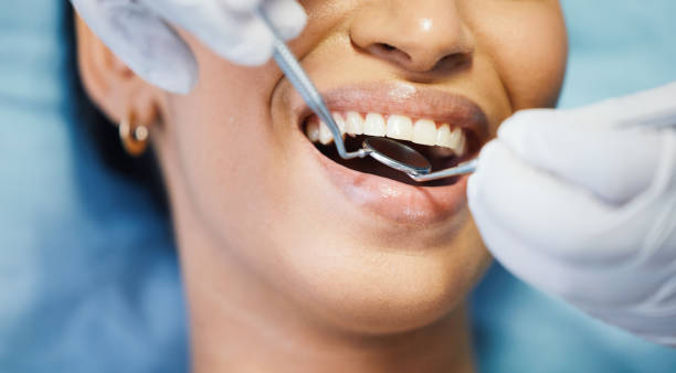 Best Emergency Treatment for Dental Infections or Abscesses in Glasgow, OR