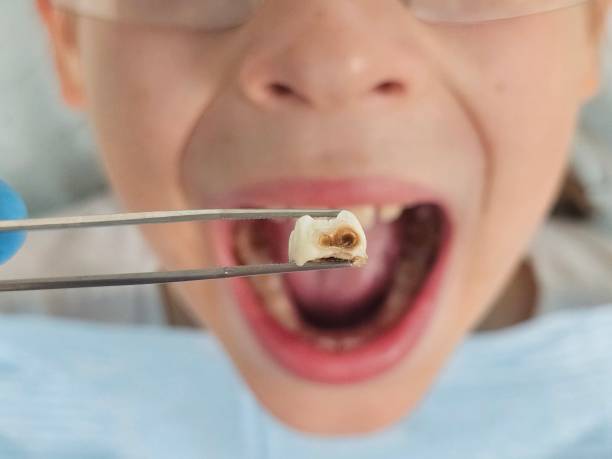 Best Emergency Gum Treatment in Glasgow, OR