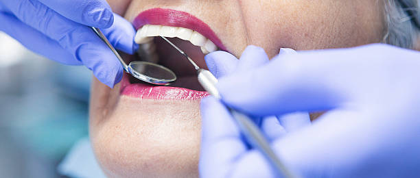 Best Emergency Denture Repair in Glasgow, OR